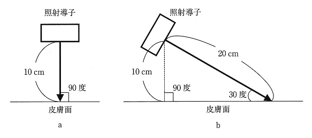 51回pt 午前問題40 極超短波治療の図を示す Aに対するbの強度はどれか ズバリ解説 理学療法士 Pt 国家試験の過去問