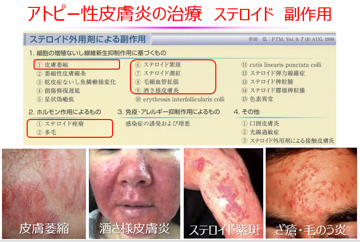 f:id:yanasettey:20210912064933p:plain