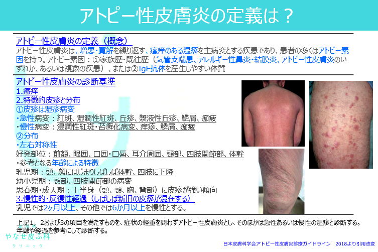アトピー性皮膚炎はこわくない アトピー性皮膚炎はこわくない アトピーが治らない理由/三好基晴