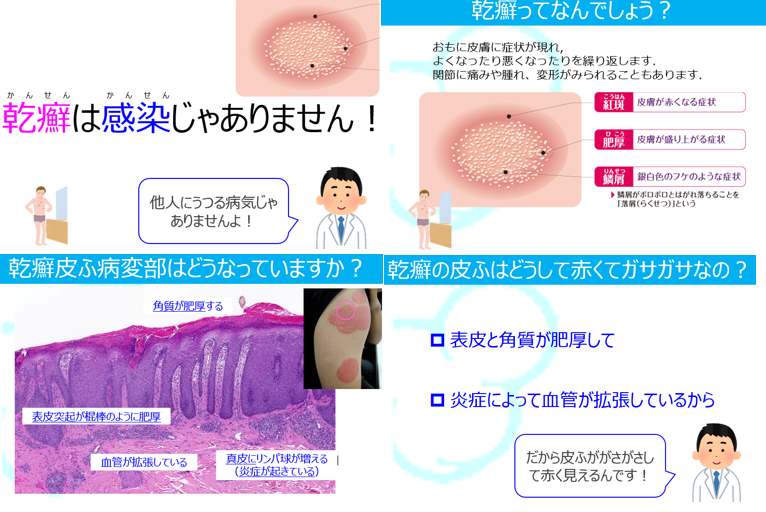 PsA でマニキュアを塗るためのヒント