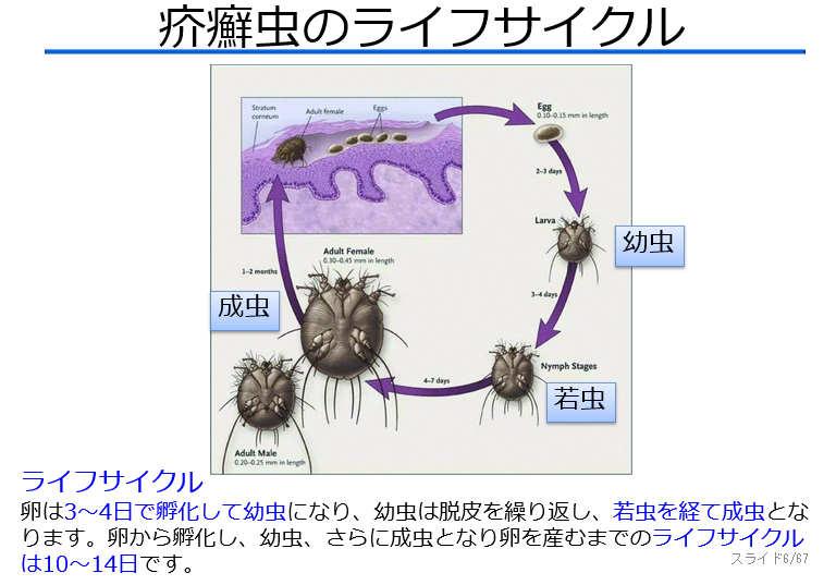 疥癬の確定診断ってなに?, 疥癬 診断方法 – VDWBD