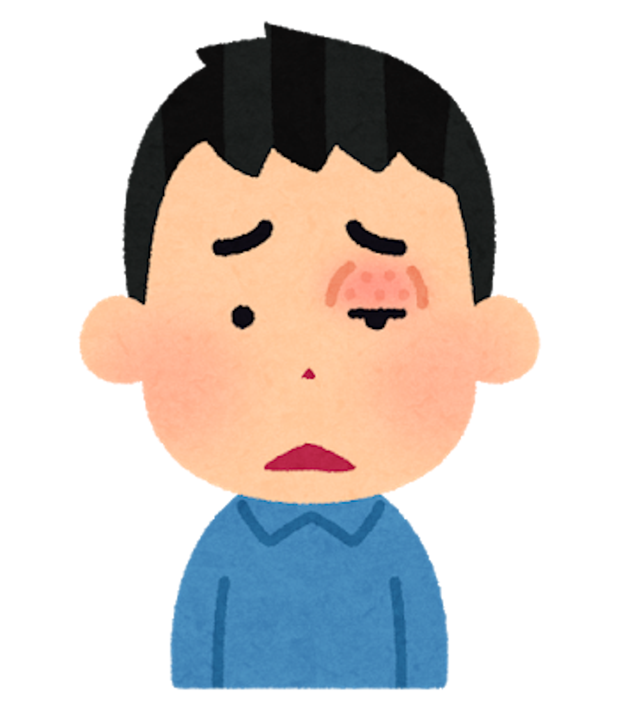 めばちこのイメージ