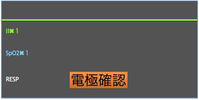 f:id:yasashi-kiki:20171025020342p:plain