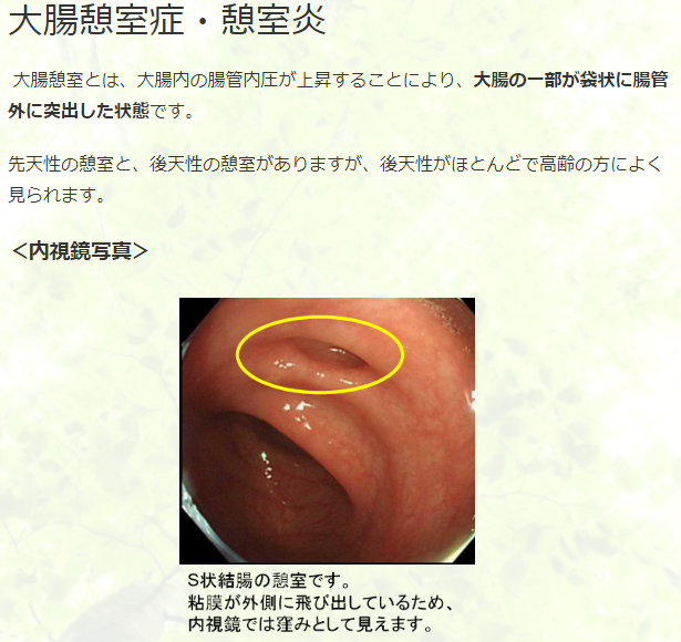 f:id:yasukazu01:20191116194533p:plain