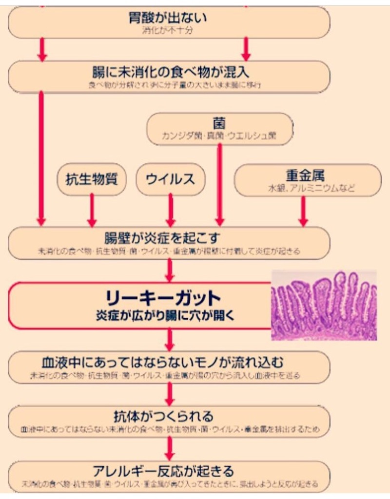 f:id:yasukoro1986227:20161028223414j:image f:id:yasukoro1986227:20161028223414j:image