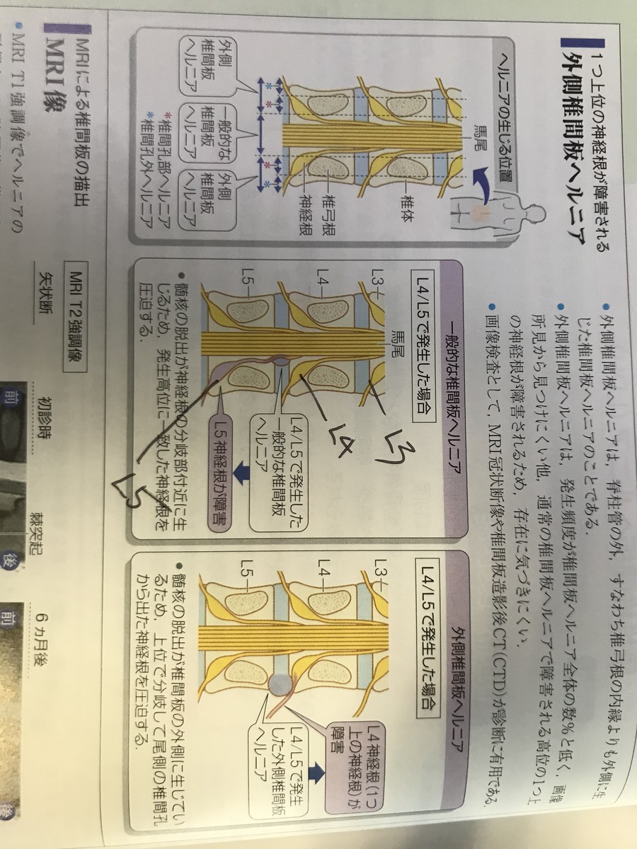 f:id:yasukunn:20220414065414j:plain