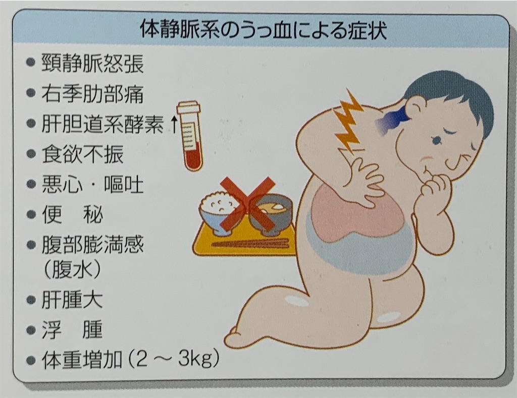 f:id:yatto-pt23:20191212181044j:image