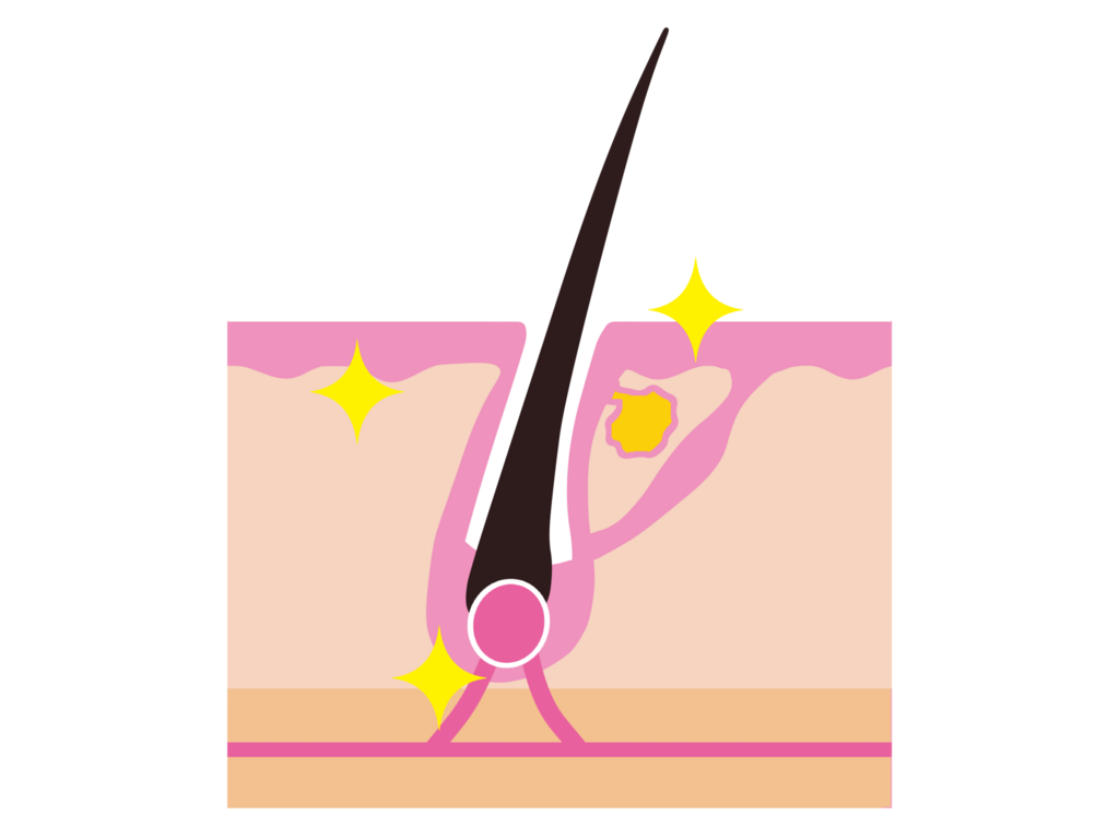 f:id:yhanamizuki:20180721062618p:plain f:id:yhanamizuki:20180721062618p:plain