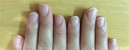 コンプレックスだった自分の爪 今はとても大事にしています イマタノ