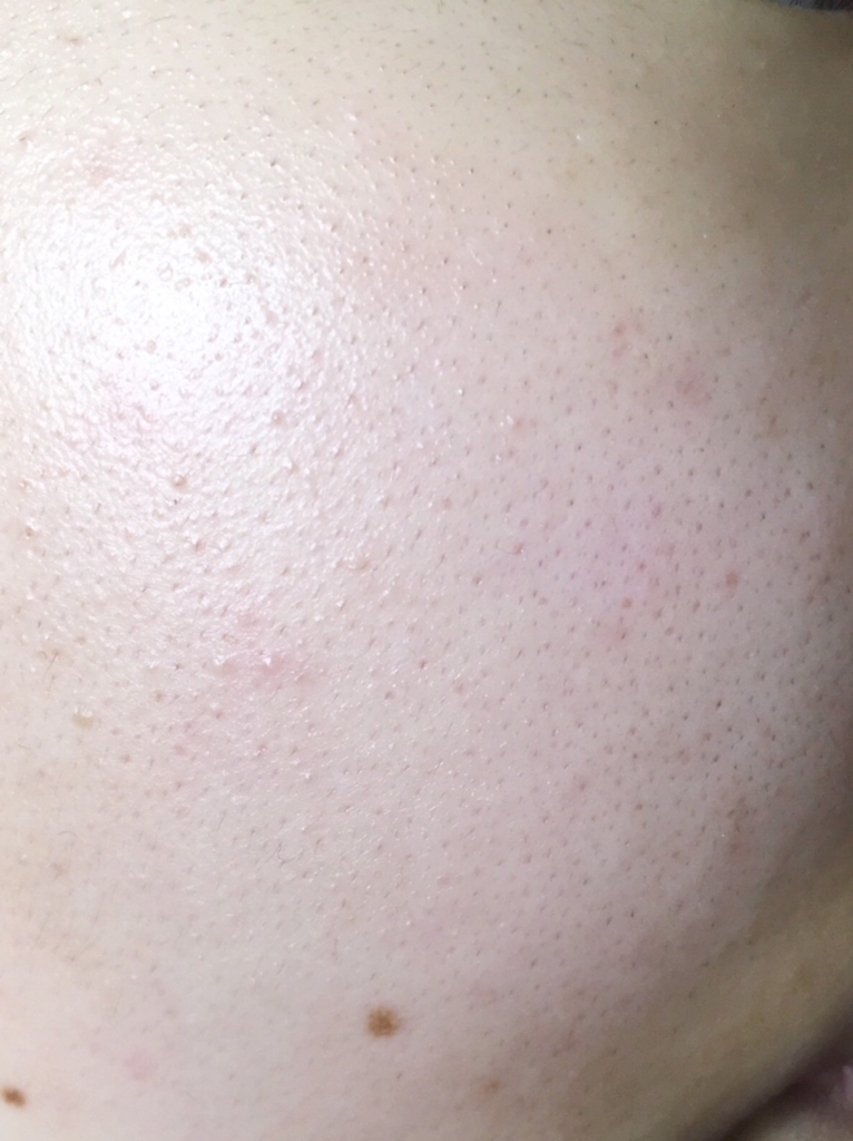 f:id:ymym1-1:20180710220552j:plain