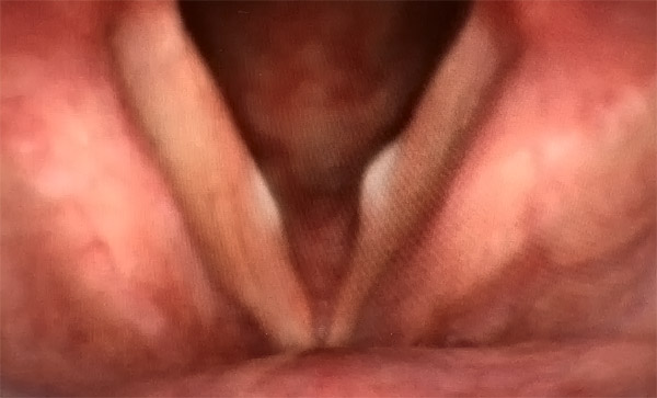 f:id:yoda_ep:20170220201824j:plain