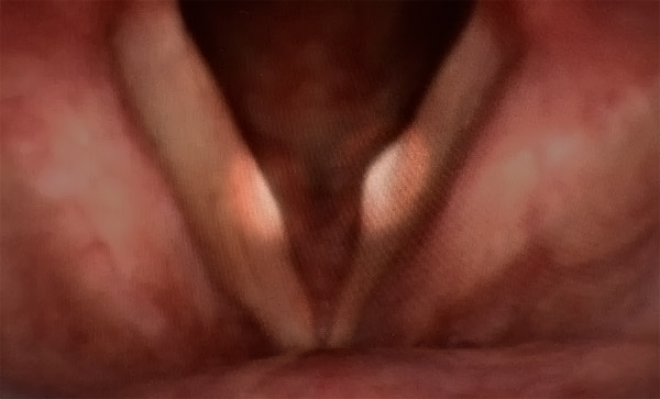 f:id:yoda_ep:20170220201826j:plain