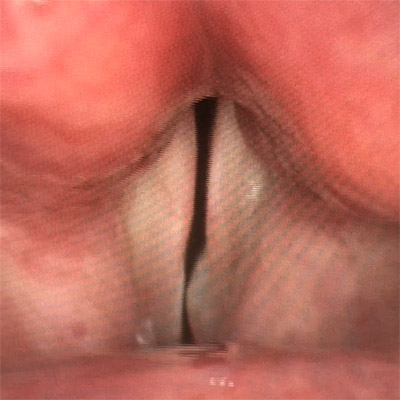 f:id:yoda_ep:20170220201832j:plain