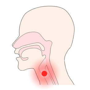 f:id:yoda_ep:20170220201846j:plain