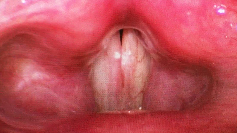 f:id:yoda_ep:20170421182659j:plain f:id:yoda_ep:20170421182659j:plain