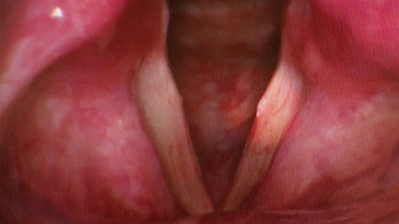 f:id:yoda_ep:20170421182702j:plain f:id:yoda_ep:20170421182702j:plain