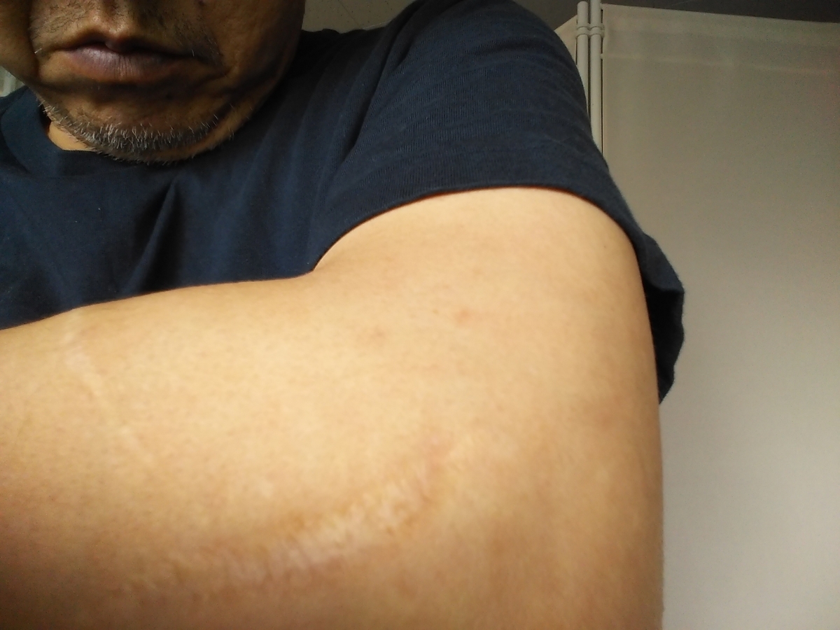 f:id:yohamada:20190705190010j:plain f:id:yohamada:20190705190010j:plain