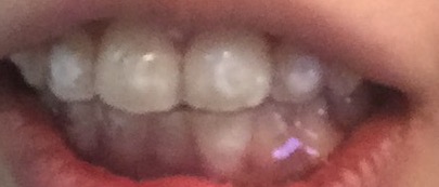 f:id:yokoyoko1111:20161114172043j:plain f:id:yokoyoko1111:20161114172043j:plain