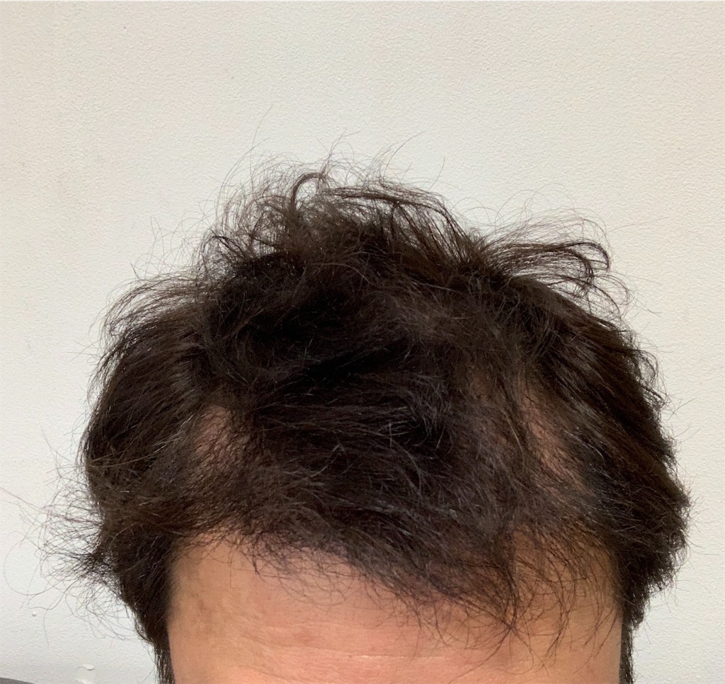 f:id:yopix777:20190416175450j:image
