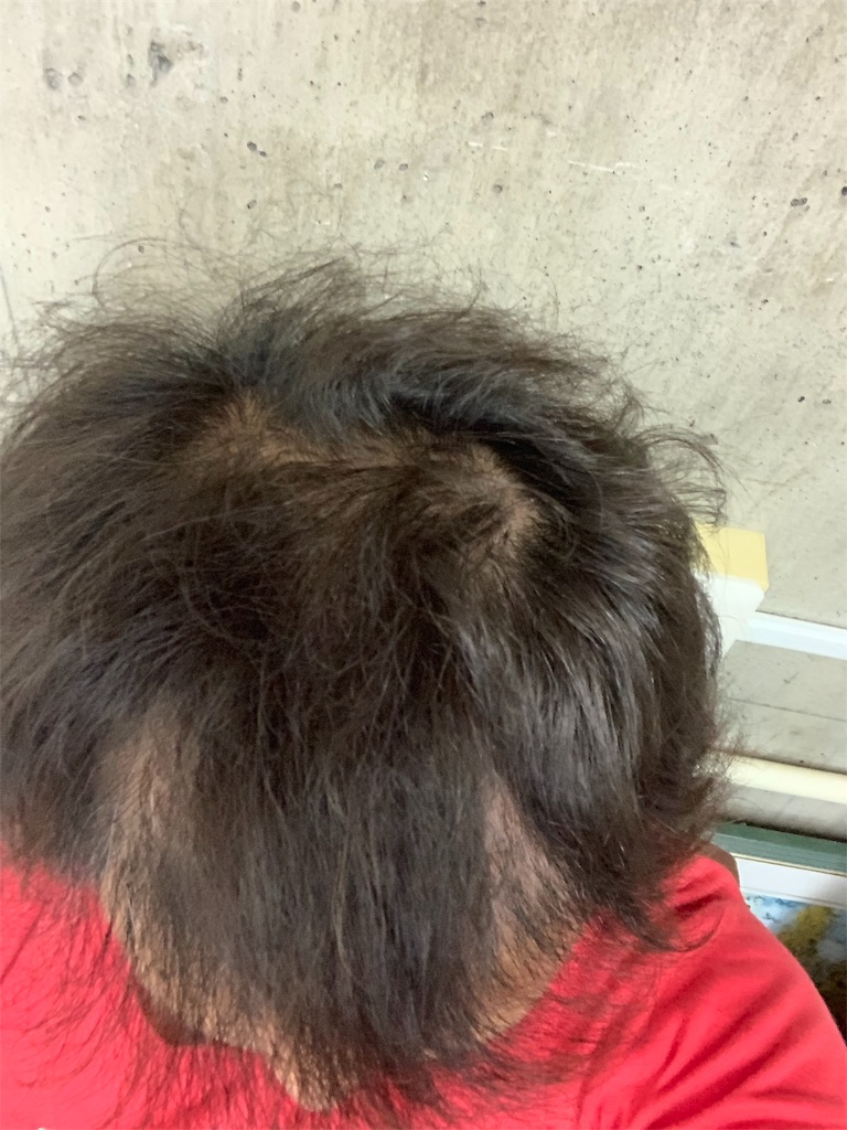 f:id:yopix777:20190516004049j:image