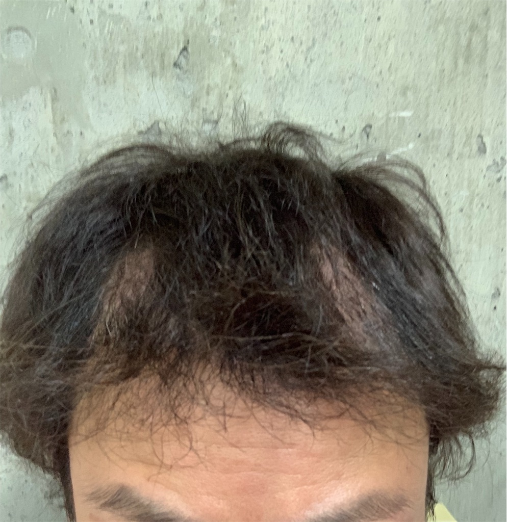 f:id:yopix777:20190516004225j:image