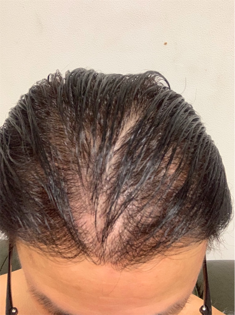 f:id:yopix777:20190817064515j:image