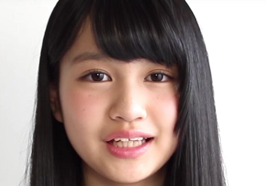 劇的変化 乃木坂46中村麗乃さん歯並びが矯正によってキレイに 大人矯正ろぐ