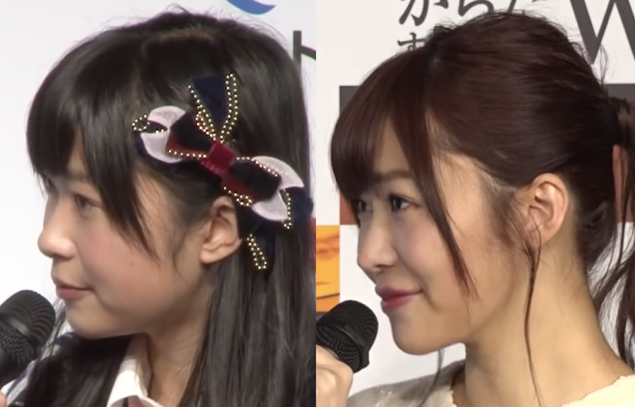 指原莉乃さんは歯の矯正で口ゴボ改善 口元が変わってよりキレイに 大人矯正ろぐ