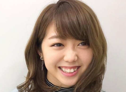 1年での変化が凄い 峯岸みなみさんの歯が矯正によってキレイになっていた 大人矯正ろぐ