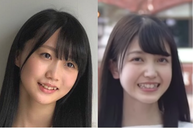 乃木坂46矢久保美緒さんが矯正中 大人矯正ろぐ