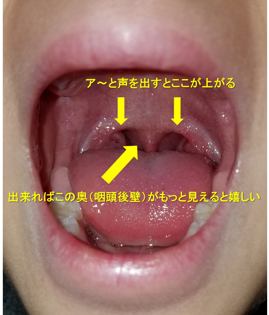 喉の奥にある第二の舌