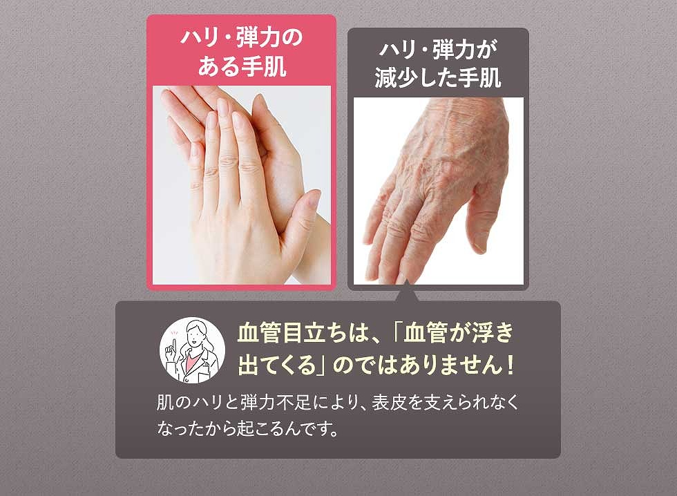 年齢サインの原因