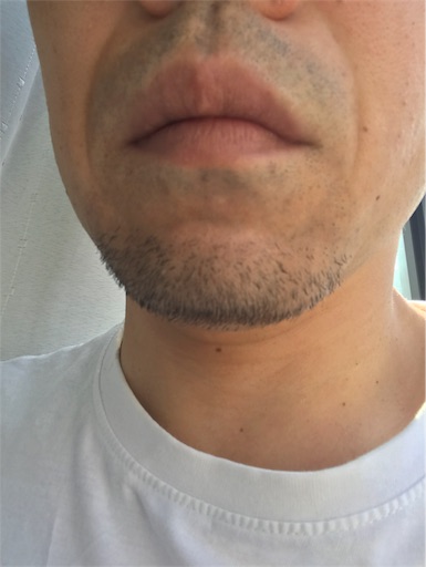 f:id:you-taro:20190818210359j:image
