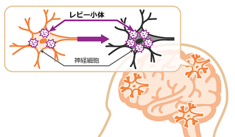 f:id:younosuke1250:20190211222609p:plain f:id:younosuke1250:20190211222609p:plain