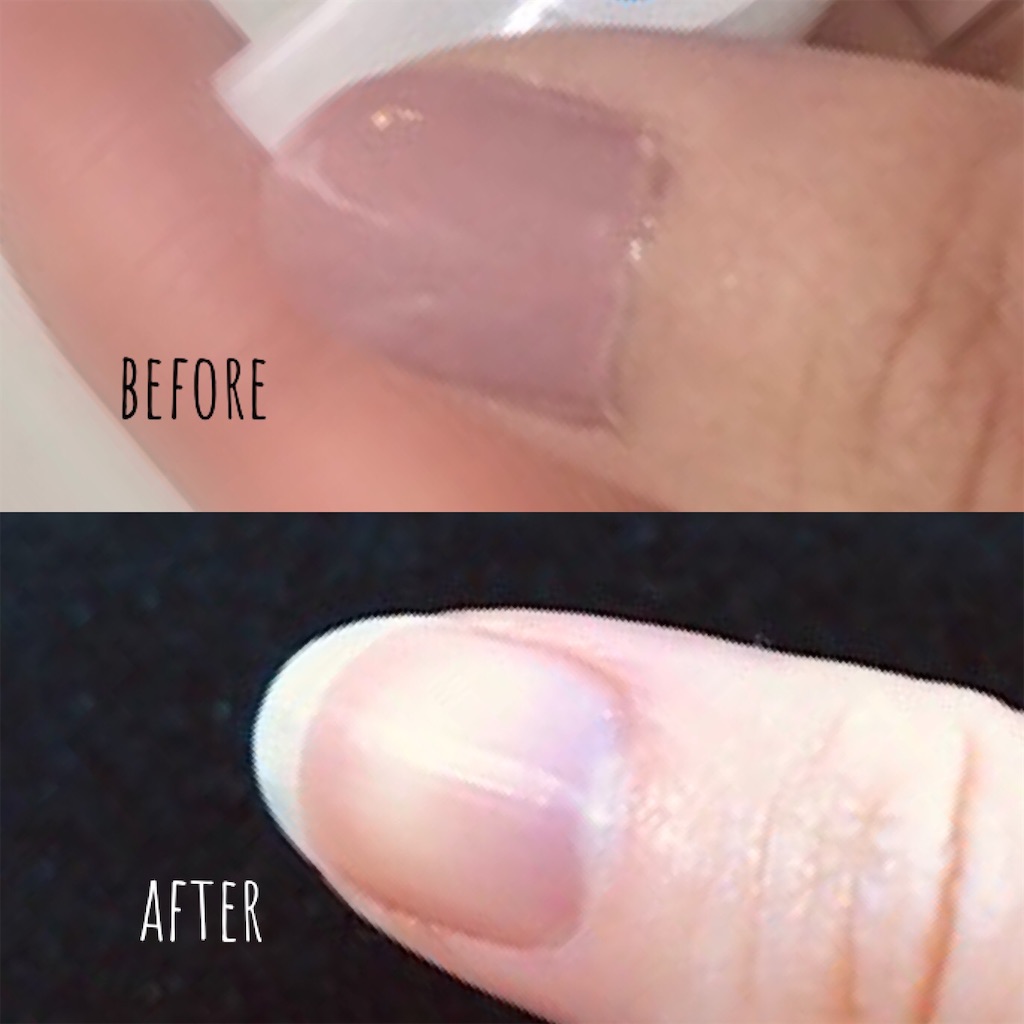 甘皮処理で美爪 がんばりすぎない日々