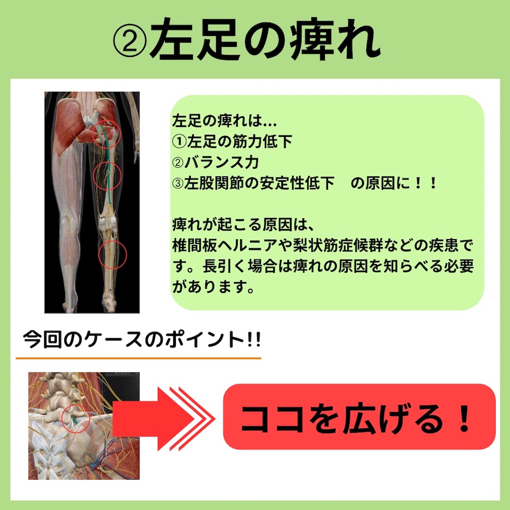f:id:yu_kiyama3:20240312135457j:image f:id:yu_kiyama3:20240312135457j:image