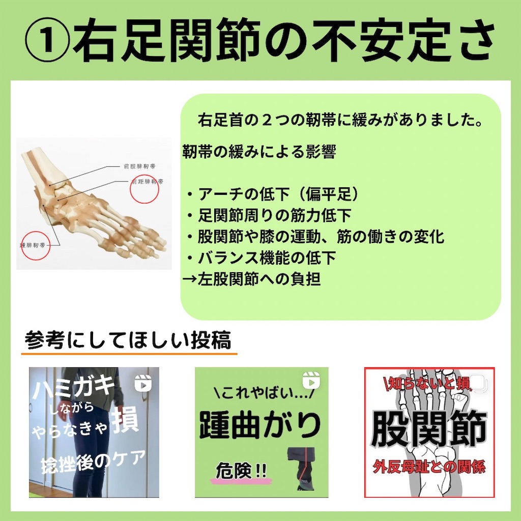 f:id:yu_kiyama3:20240312135619j:image f:id:yu_kiyama3:20240312135619j:image