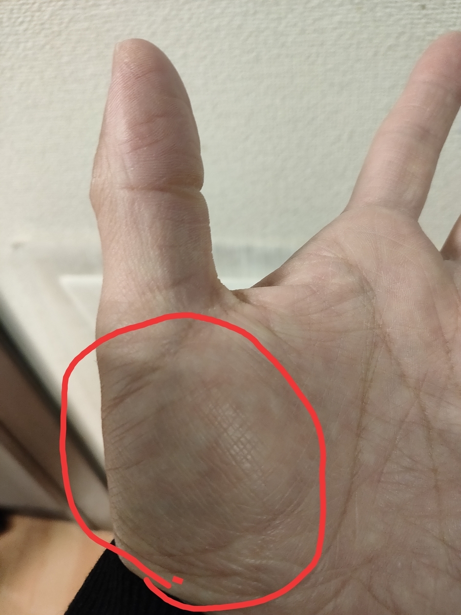 スマホの操作に気を付けて下さい! - ゆあさ鍼灸接骨院 日々あれこれ