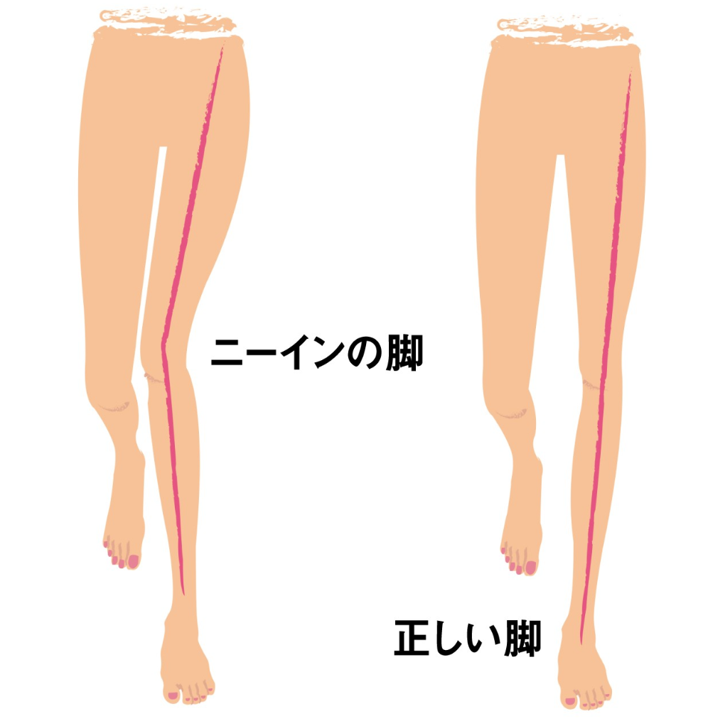 ニーインで傷めやすい部位は？ - ゆあさ鍼灸接骨院 日々あれこれ