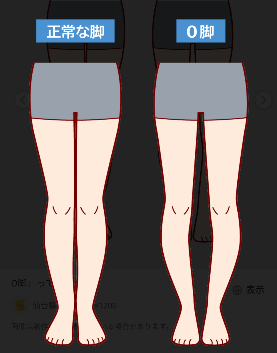 O脚かどうか見極める方法！ - ゆあさ鍼灸接骨院 日々あれこれ