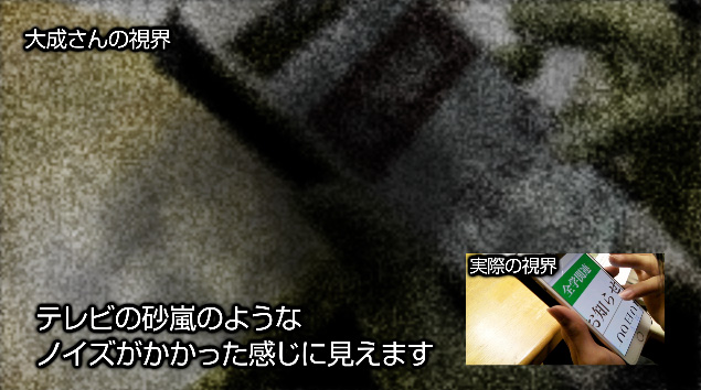 ビジュアル スノウ