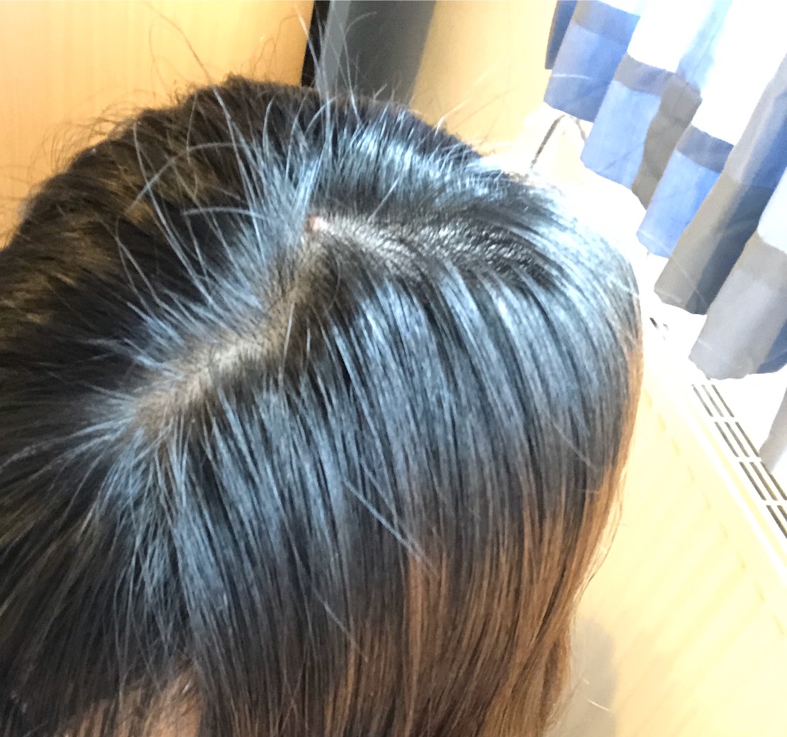 f:id:yui_deutsch:20200305040937j:plain f:id:yui_deutsch:20200305040937j:plain