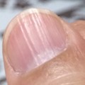 20141226212516