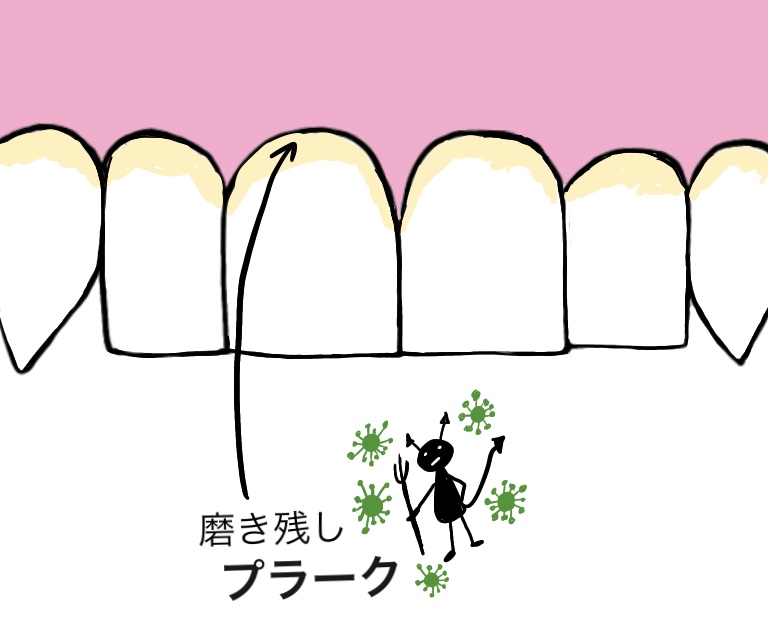 f:id:yuka-tama:20200409185240j:plain f:id:yuka-tama:20200409185240j:plain