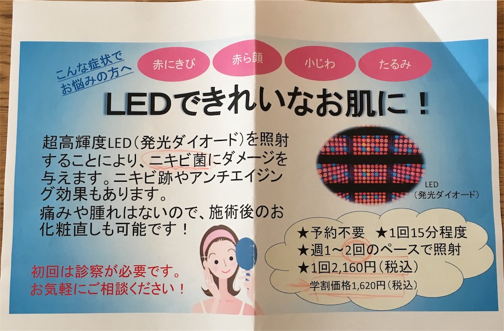 f:id:yukanzel:20180315111612j:image
