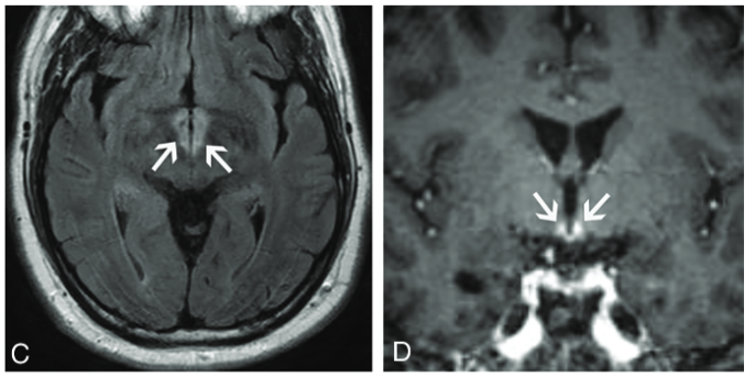 f:id:yukimukae:20210326173044p:plain