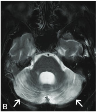 f:id:yukimukae:20210326173244p:plain