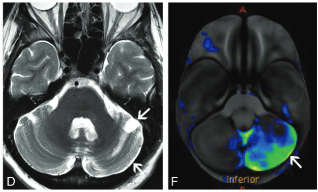 f:id:yukimukae:20210326173313p:plain