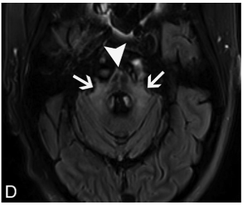 f:id:yukimukae:20210326173442p:plain