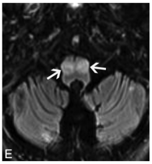 f:id:yukimukae:20210326173458p:plain